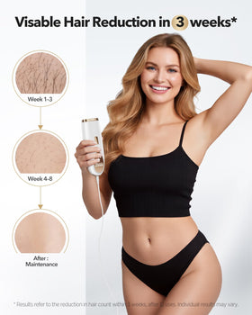 Oreeth IPL flash window detail highlighting precise light delivery benefit