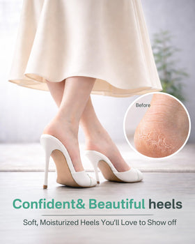 Originbuty before-and-after heels illustration showing improved skin softness