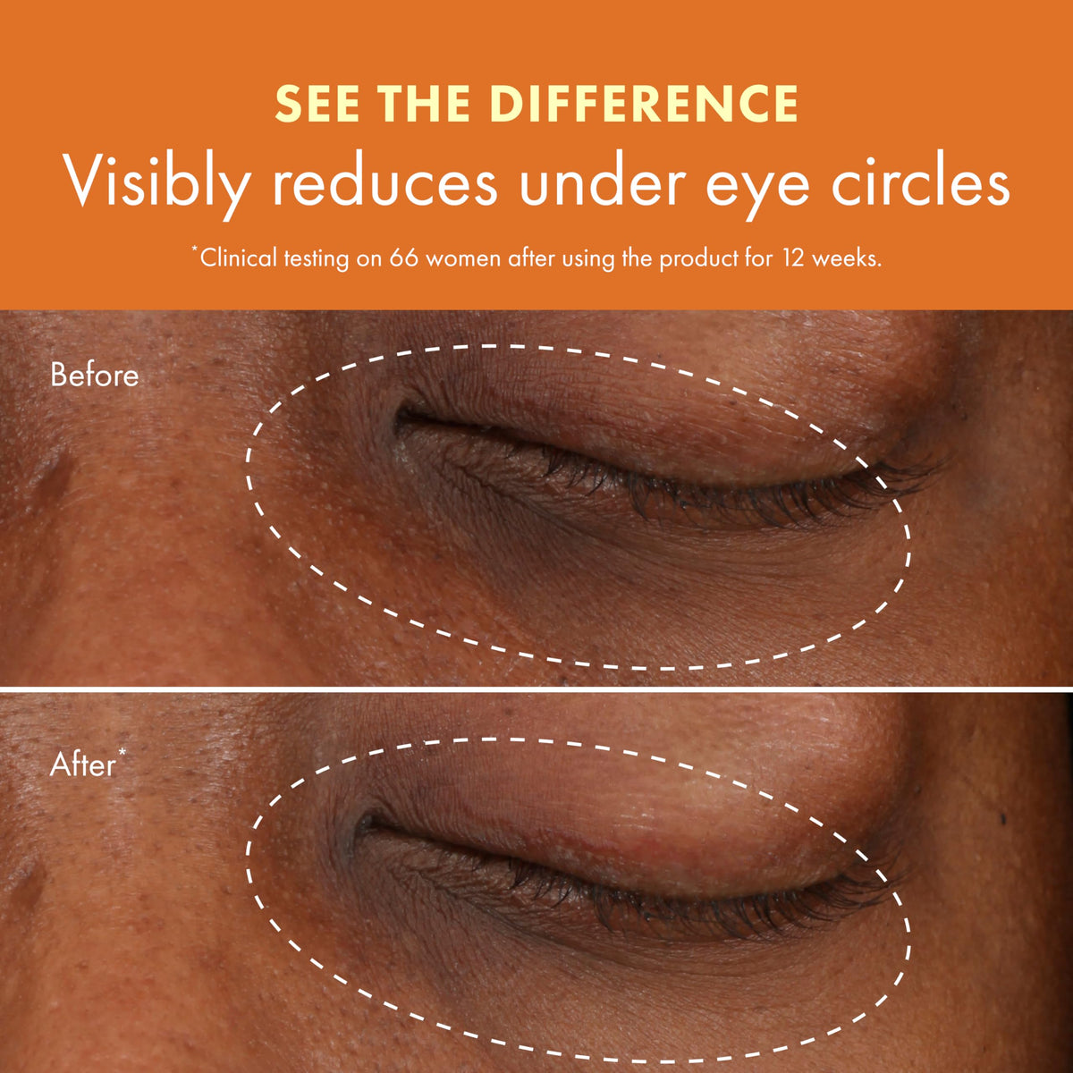 Origins GinZing application demonstration patting under eye to reduce puffiness benefit