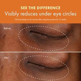 Origins GinZing warm application demonstrating under-eye placement, reduces puffiness look