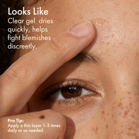 Origins spot treatment label close-up showing salicylic acid ingredient for clearing pores