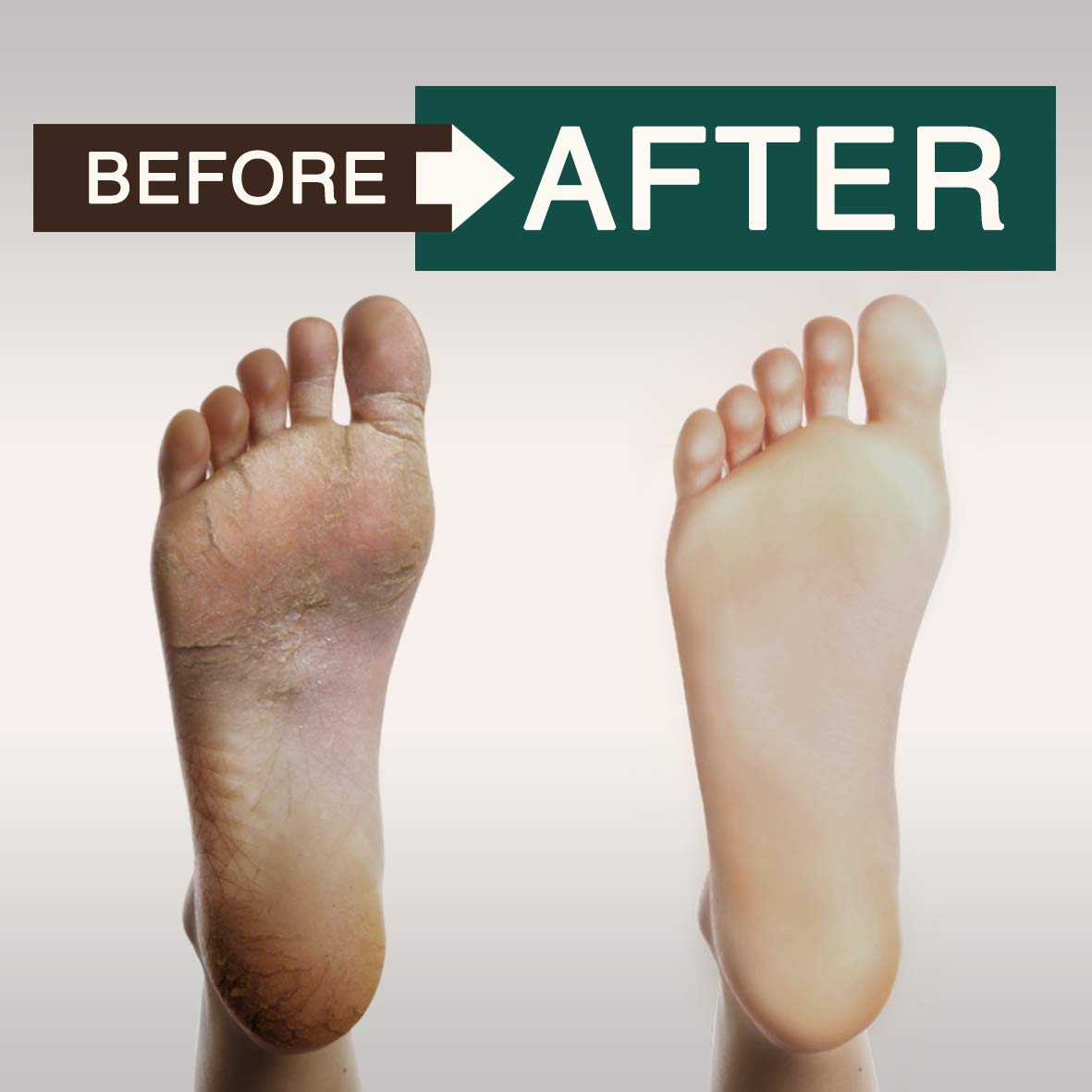 ORISO sulfate-free claim badge emphasizing gentle formula and reduced irritation potential