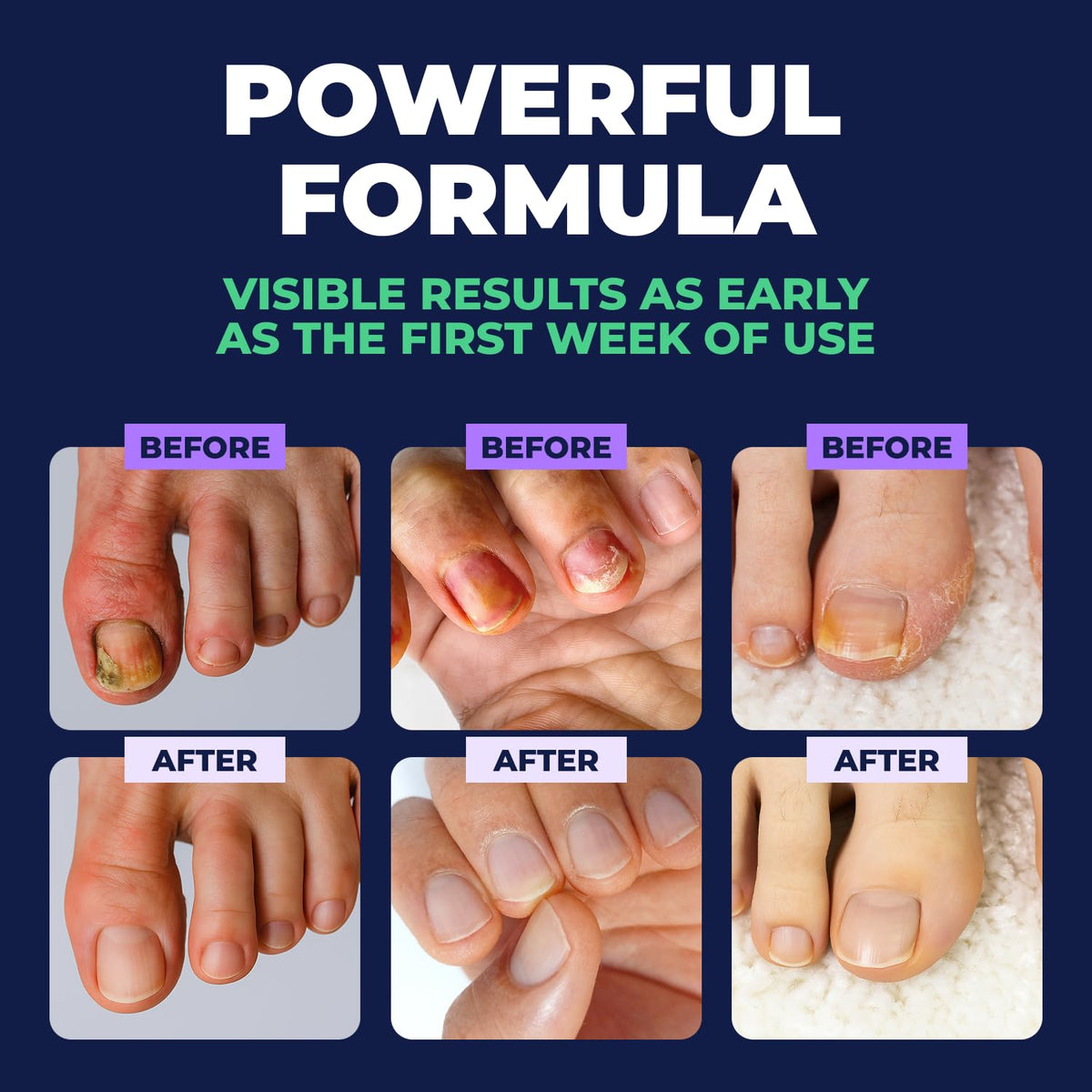 Orivelle in a pedicure setting showing refreshed nails and grooming routine