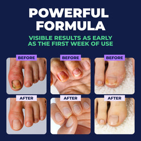 Orivelle in a pedicure setting showing refreshed nails and grooming routine