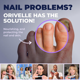 Orivelle pen next to hand for size comparison and portable convenience