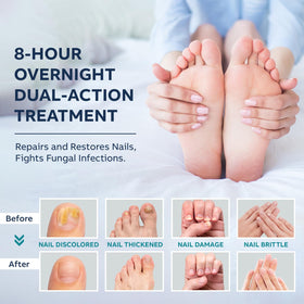 OSIMOON patch sheet detail showing adhesive patches protecting nails overnight