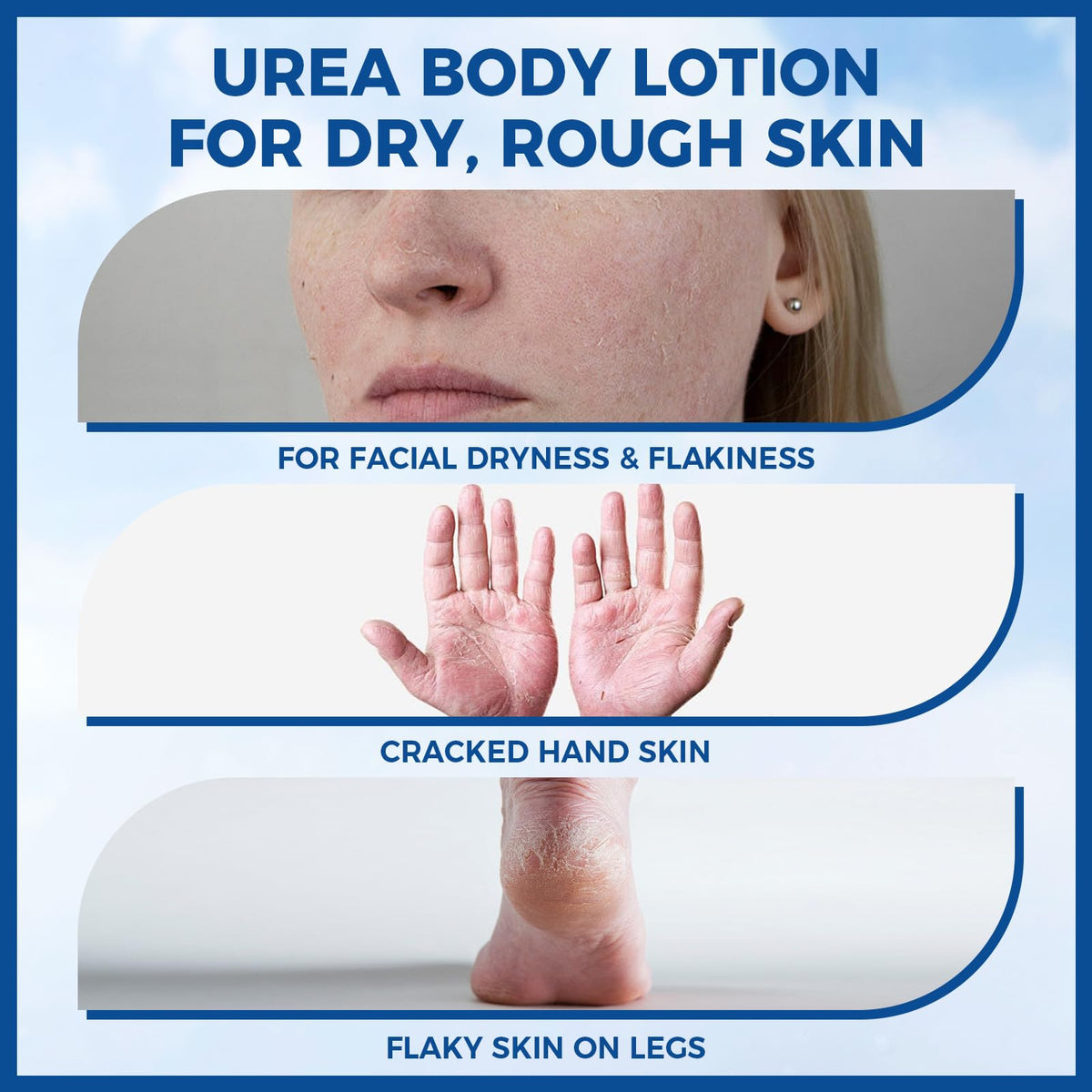 OUKEYA applying cream to hands for fast hydration and comfort benefit