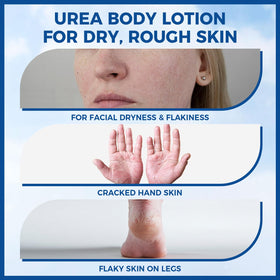 OUKEYA applying cream to hands for fast hydration and comfort benefit