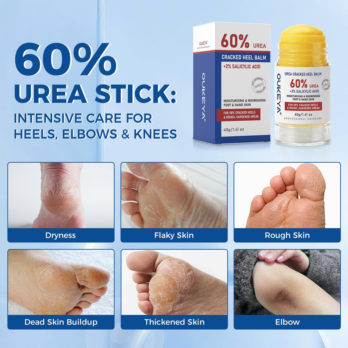 OUKEYA applying stick to heel to soften and exfoliate rough skin
