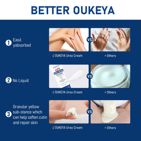 OUKEYA hand application demonstrating targeted use and immediate softer feel