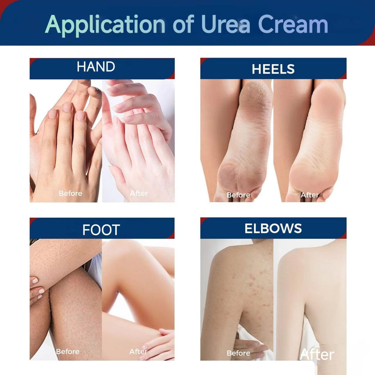 OUKEYA label close-up displaying key actives like 42% urea and 2% salicylic acid