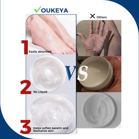 OUKEYA before and after heels showing improved smoothness