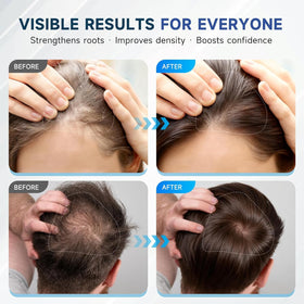 OVEXLIO label close-up highlighting biotin and rosemary ingredients