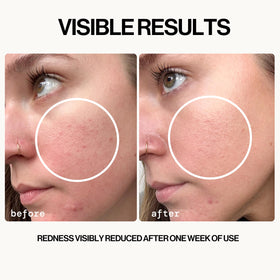 Pacifica fine mist spraying onto face demonstrating a refreshing, non-sticky finish
