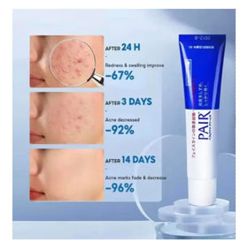 Generic PAIR acne cream packaging label detail showing medicated formula clarity