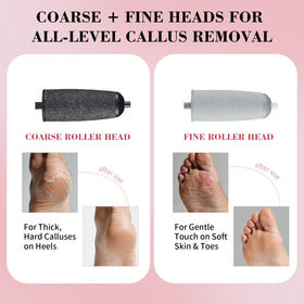 PALETTECH close-up of coarse roller head highlighting aggressive grit for fast callus removal