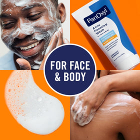 PanOxyl being applied to face showing targeted acne-clearing benefit