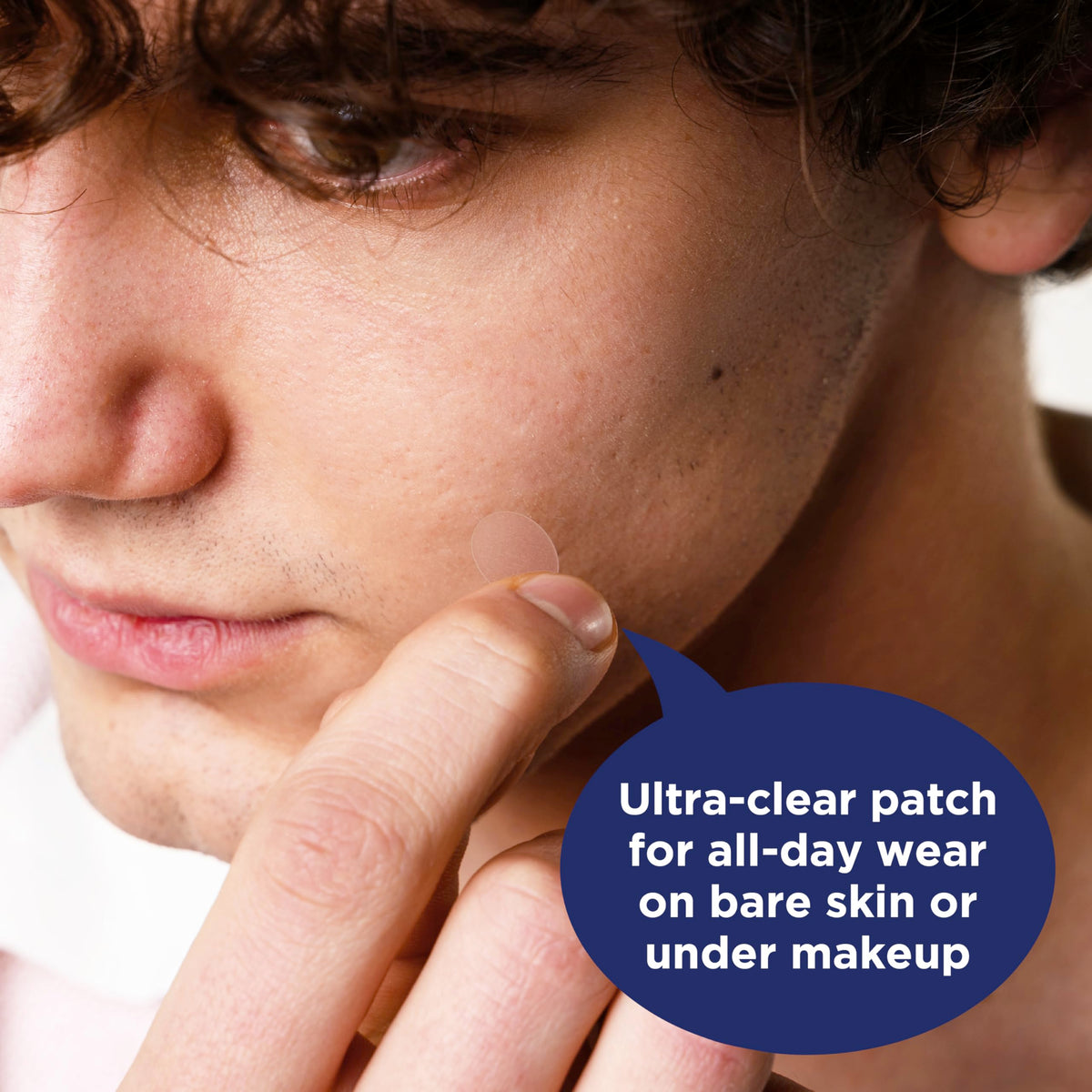 PanOxyl patch applied on cheek under makeup demonstrating invisible coverage