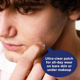 PanOxyl patch applied on cheek under makeup demonstrating invisible coverage