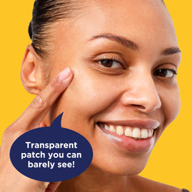 PanOxyl two patch sizes 9mm and 12mm demonstrating coverage options