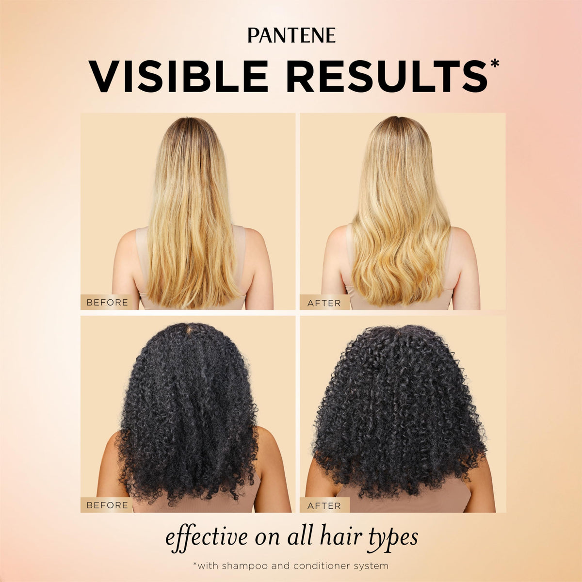 Full Pantene three-piece set laid flat for routine coordination and ease