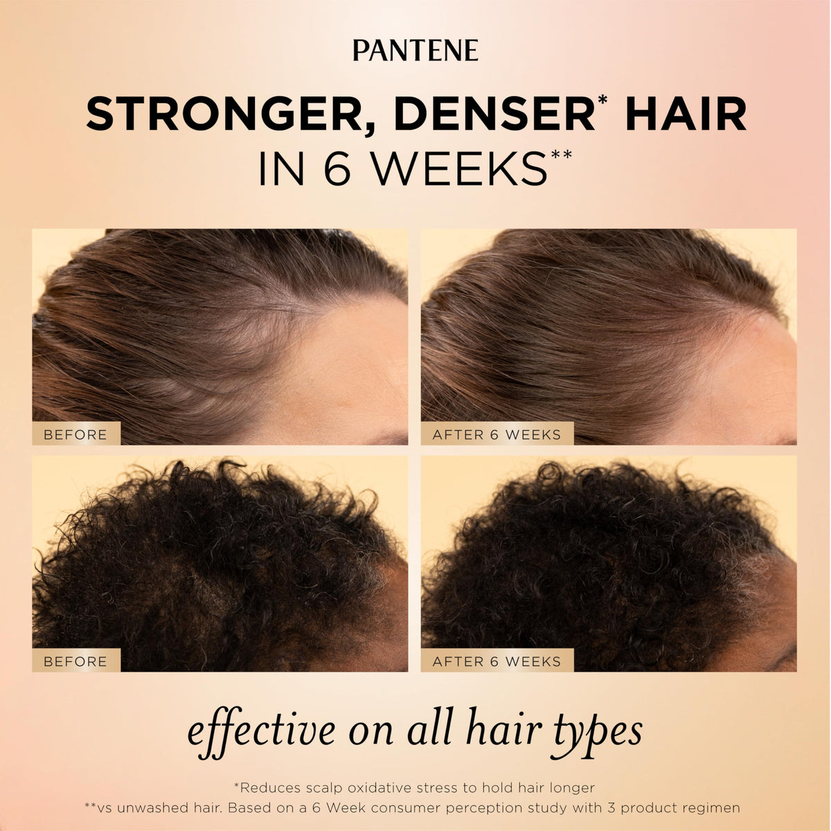 Pantene serum dropper dispensing product for targeted scalp nourishment