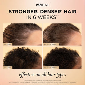 Pantene serum dropper dispensing product for targeted scalp nourishment
