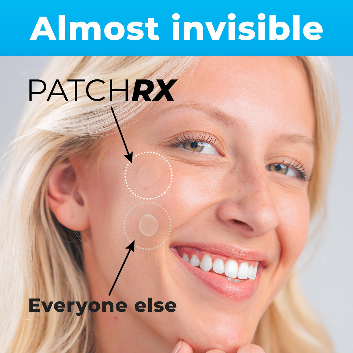 PatchRx patch applied on cheek preventing picking and protecting