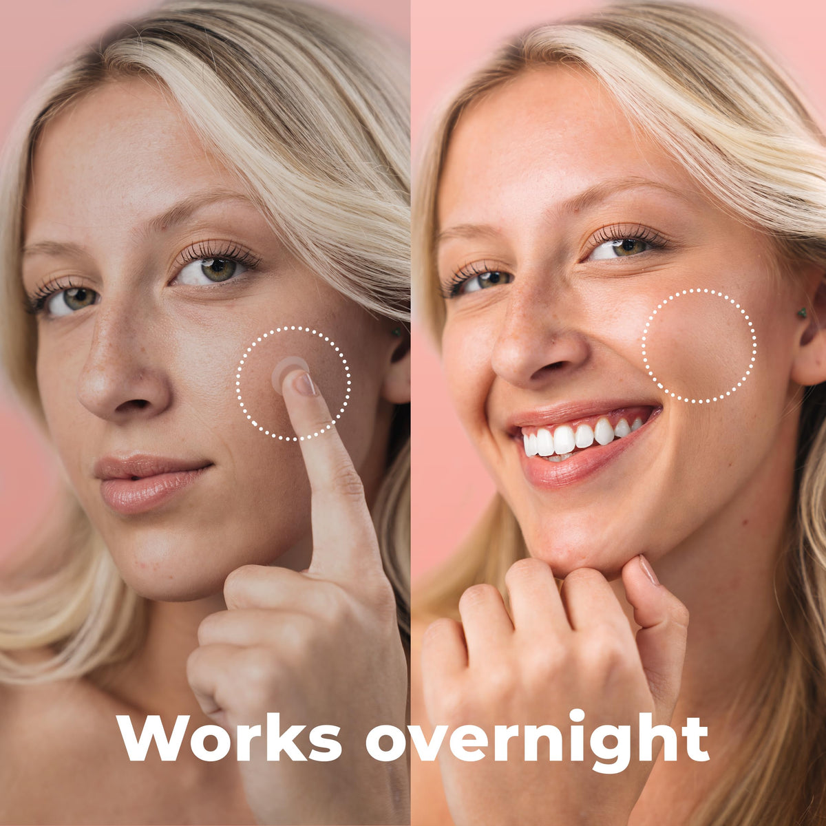 PatchRx patch applied on cheek showing discreet protection
