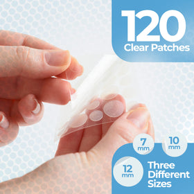 PatchRx applied on cheek demonstrating discreet wear and protection of a pimple