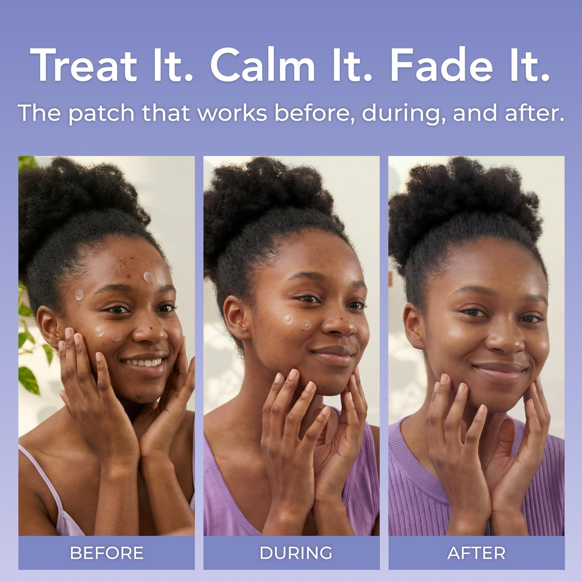 PatchRx patch applied on cheek protecting blemish during wear
