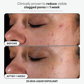 Paula's Choice 2% BHA liquid texture close-up demonstrating gentle exfoliation benefit