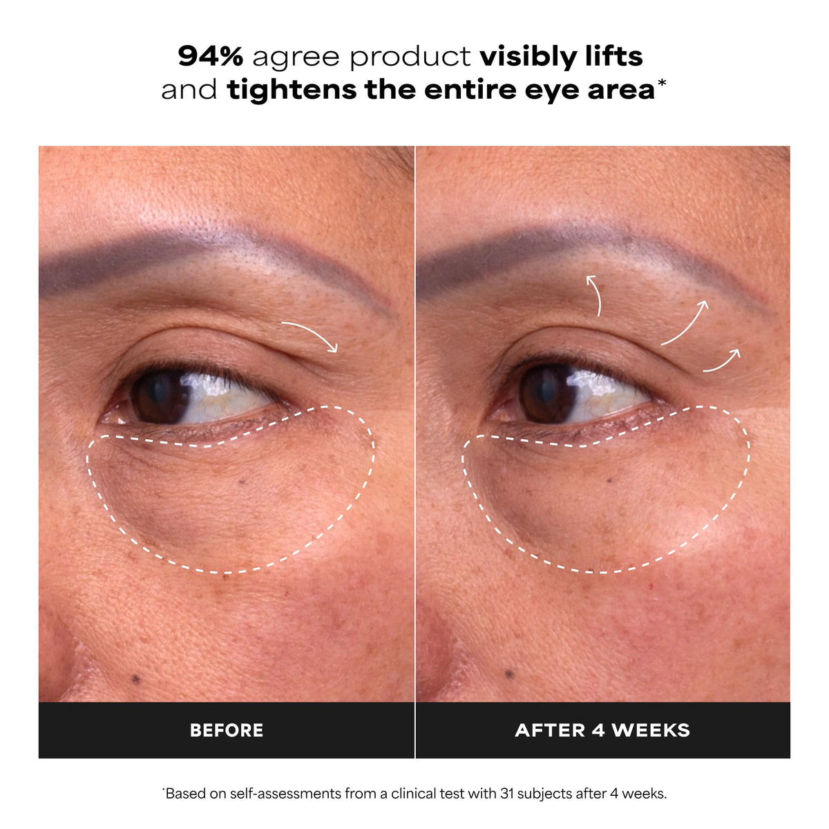 Paula's Choice cooling applicator close-up delivering soothing, depuffing contact