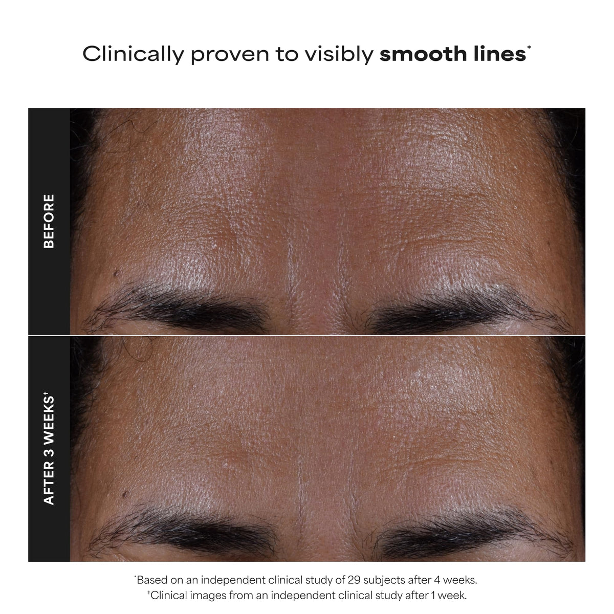 Paula's Choice label detail showing 2% salicylic acid for pore clarity