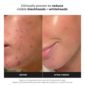 Paula's Choice liquid texture close-up highlighting lightweight absorption