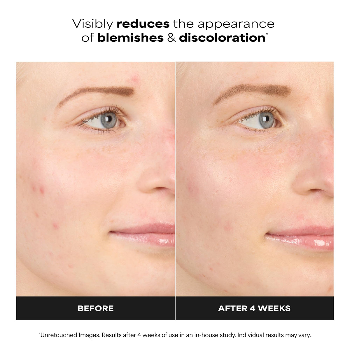 Paula's Choice gel texture close-up with drops demonstrating lightweight, fast-absorbing finish