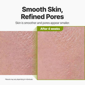 P.CALM rinsing mask with water illustrating gentle removal and clean skin