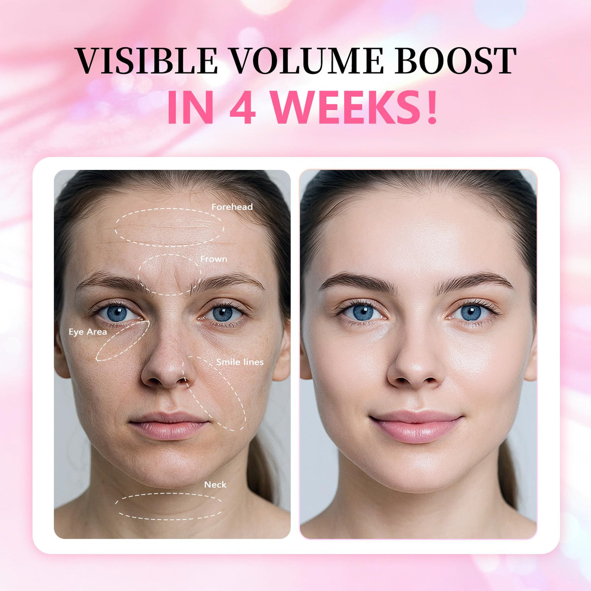 Generic PDRN Pink Collagen applied under-eye demonstrating dewy plumping benefit