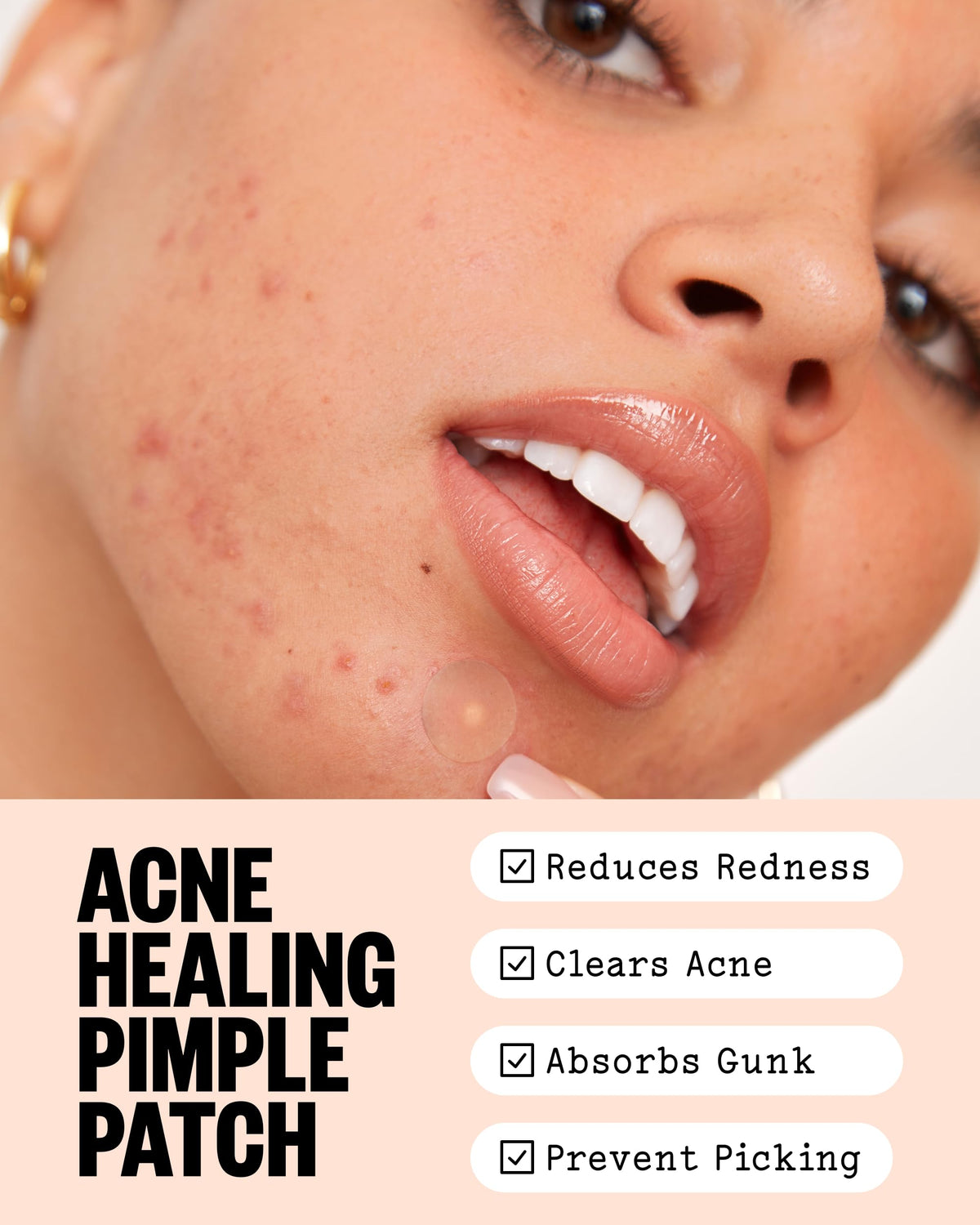 PEACE OUT close-up of single hydrocolloid dot texture, highlights thin adhesion
