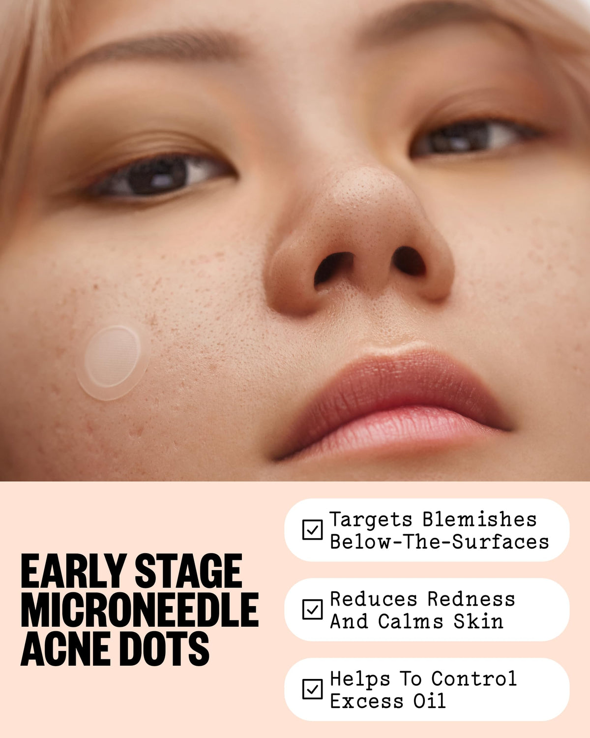 PEACE OUT close-up of dissolving microneedles delivering active ingredients