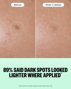 PEACE OUT dot applied to cheek demonstrating targeted spot treatment
