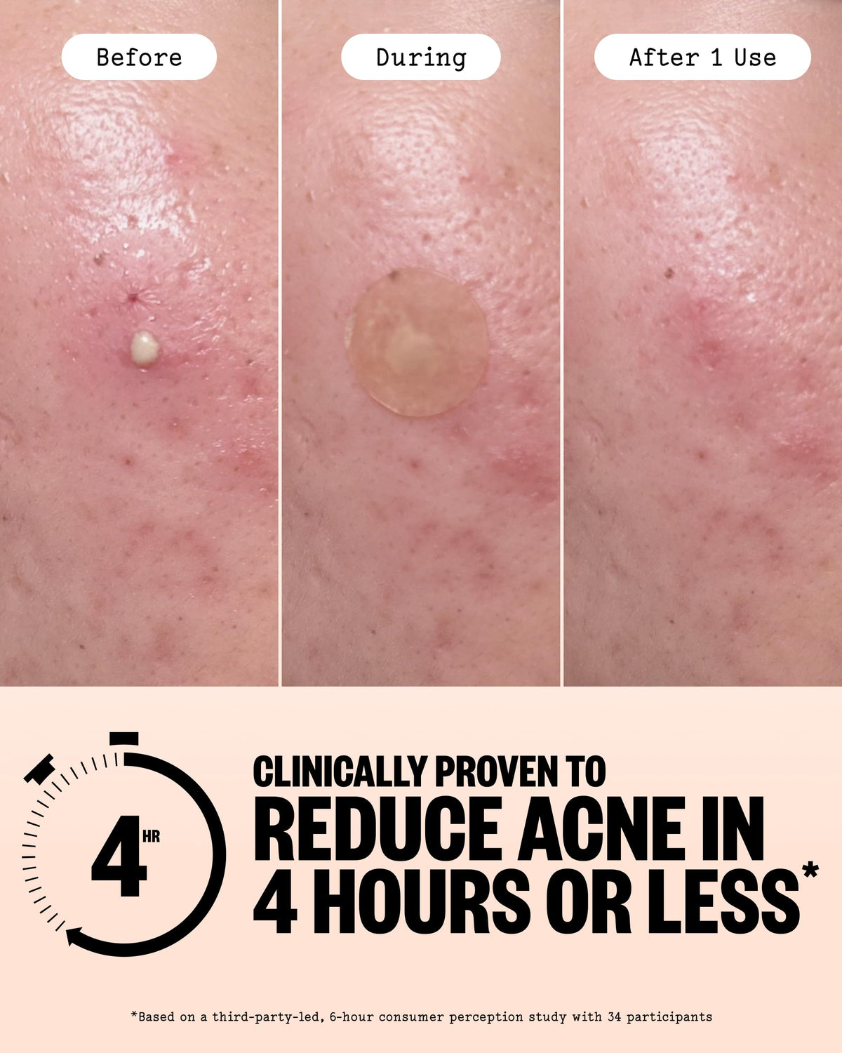 PEACE OUT dot applied to cheek, demonstrates protective coverage benefit