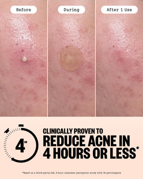 PEACE OUT dot applied to cheek, demonstrates protective coverage benefit