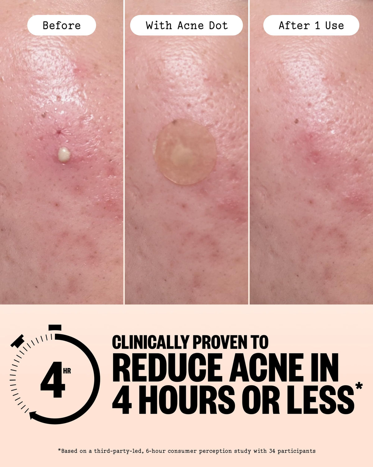 PEACE OUT close-up Healing Dot showing active salicylic application benefit