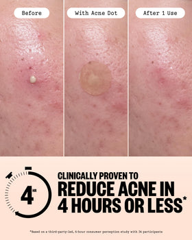 PEACE OUT close-up Healing Dot showing active salicylic application benefit