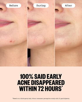 PEACE OUT patch applied to cheek demonstrating discreet in-use protection