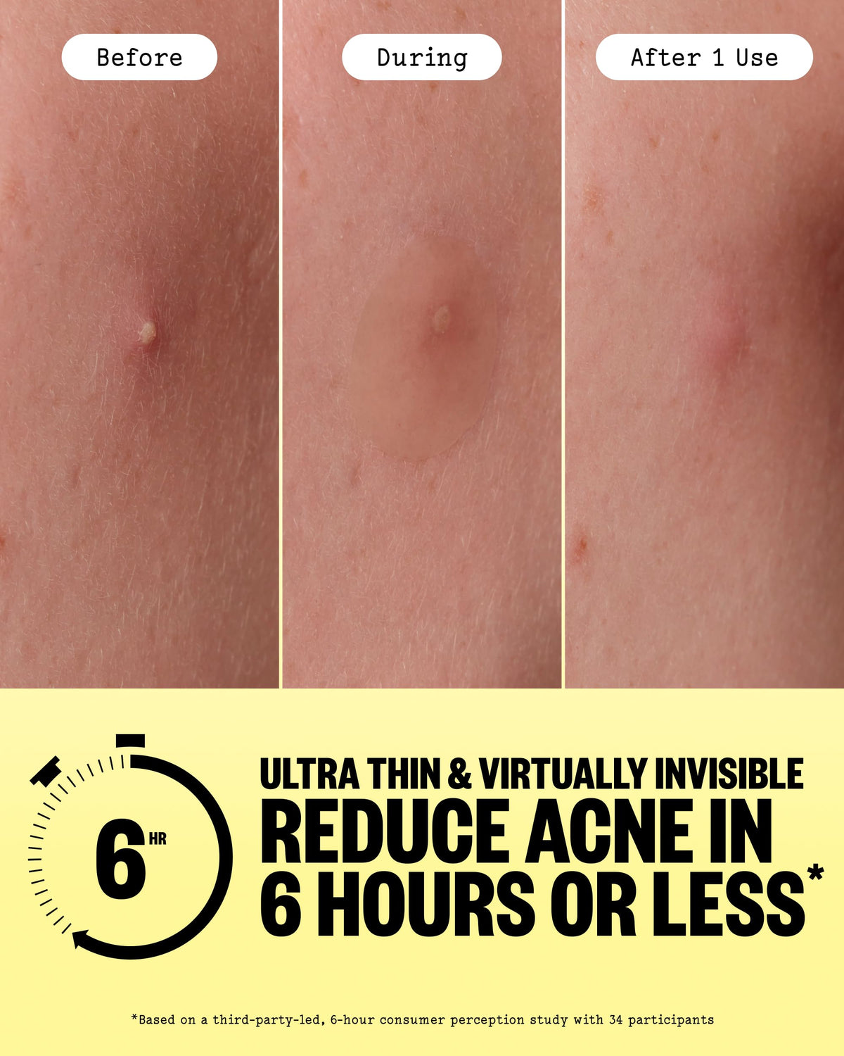 PEACE OUT patch applied on skin blending invisibly for discreet wear