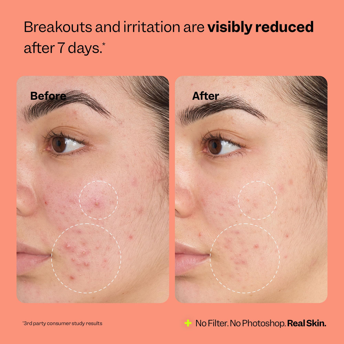 Peach Slices used over makeup to soothe redness without disturbing coverage