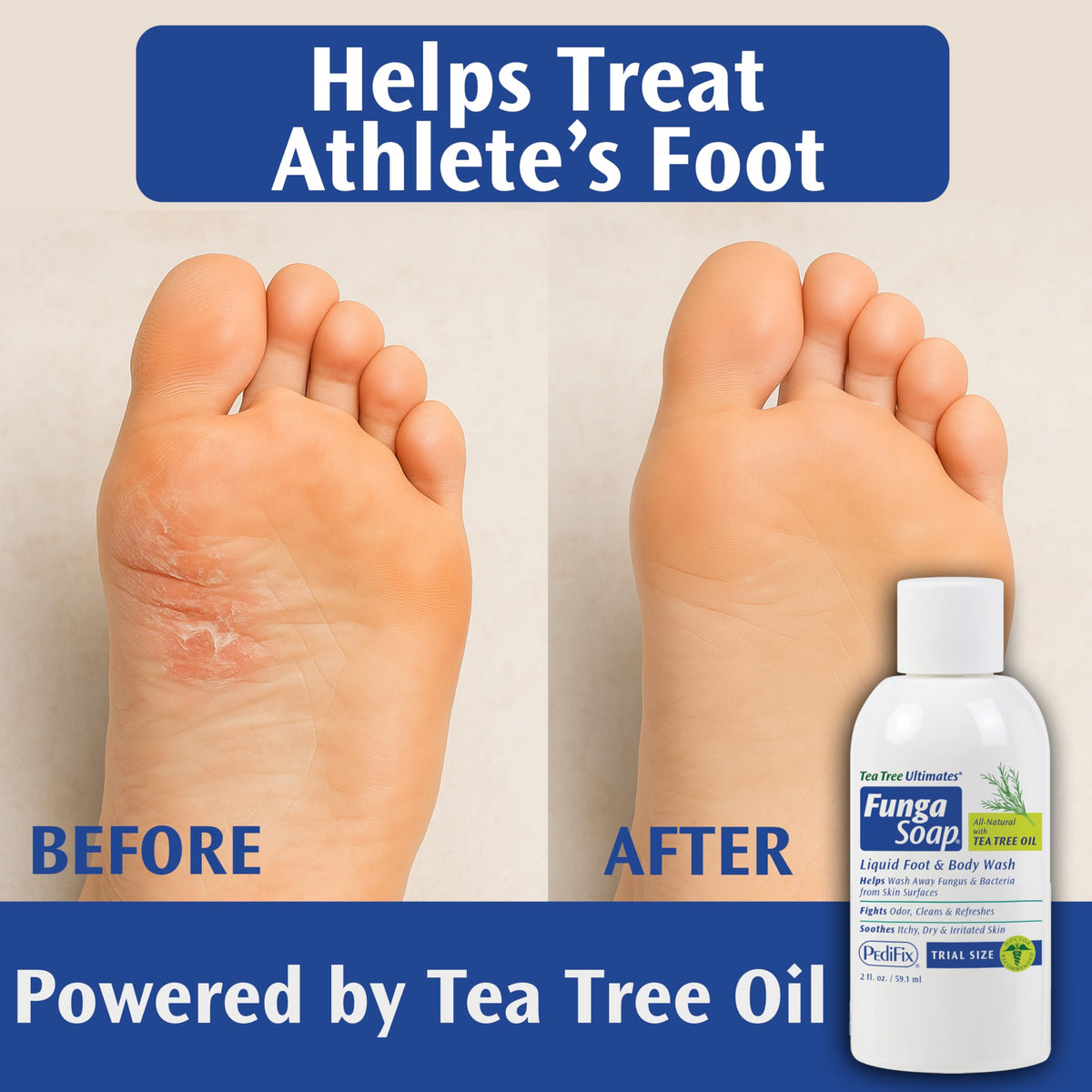 Pedifix FungaSoap being applied between toes illustrating targeted foot care benefit