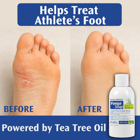 Pedifix FungaSoap being applied between toes illustrating targeted foot care benefit